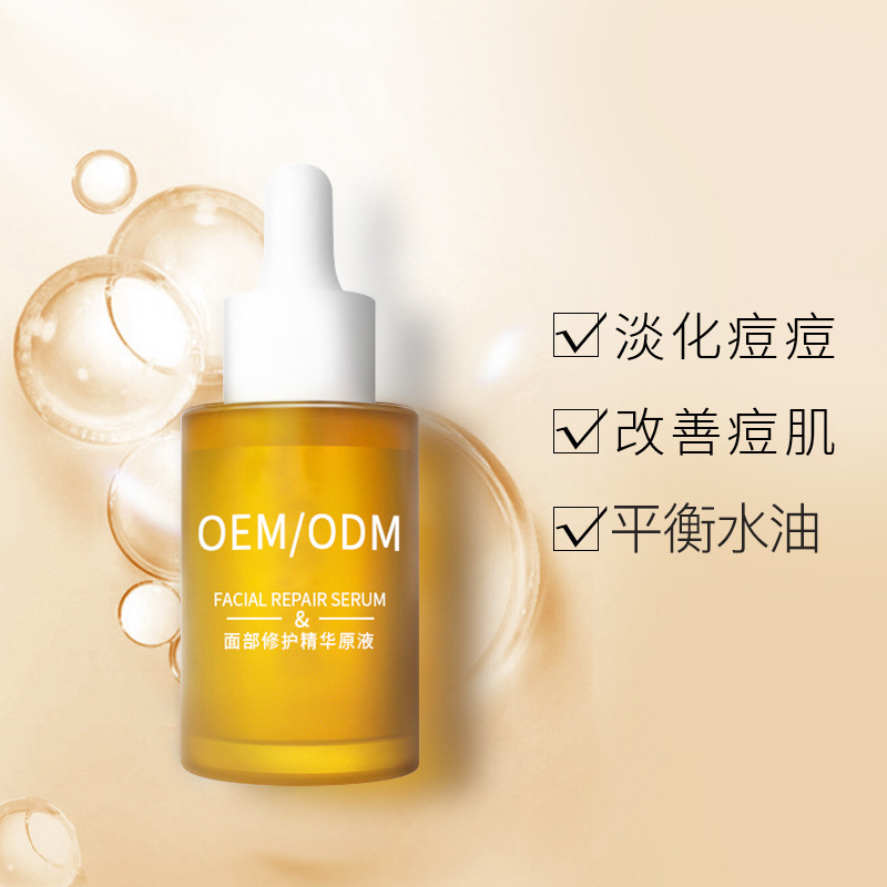 海南_祛痘精华原液OEM